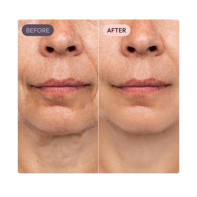 Limosia CollaGlow Balm