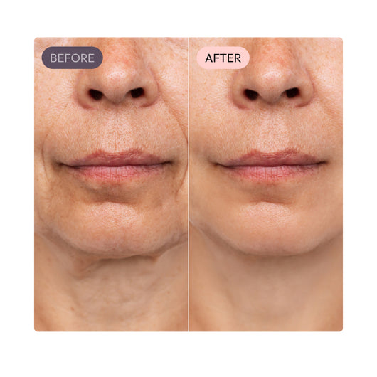 Limosia CollaGlow Balm